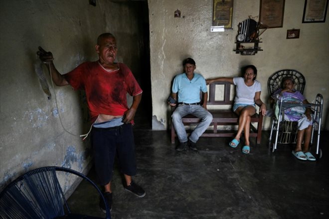 José Gregorio Mejia, qui doit être opéré d'une obstruction urinaire, montre sa poche d'urine, le 1er juillet 2024 à Biscucuy, dans l'ouest du Venezuela